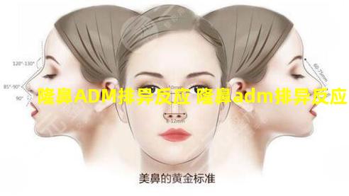 隆鼻ADM排异反应 隆鼻adm排异反应